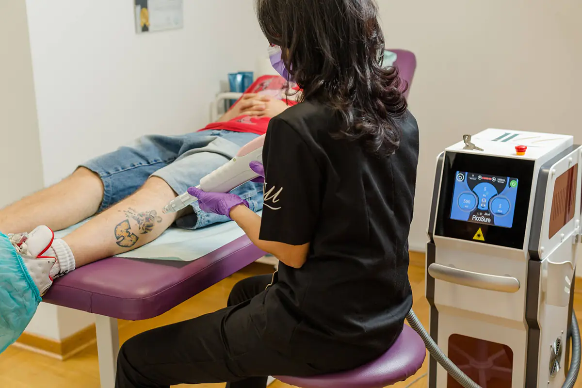 Tattoo removal | Lepo-Lepše | Antiaging and beauty care, Belgrade Tattoo removal | Lepo-Lepše | Antiaging and beauty care, Belgrade