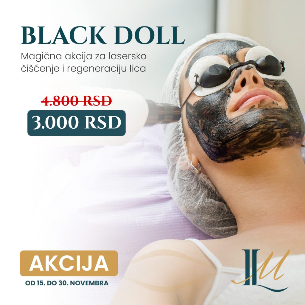 Akcija Black Doll